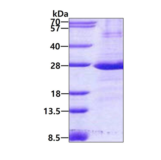 SDS-PAGE gel showing recombinant human CD32a FCGR2A protein under reducing conditions