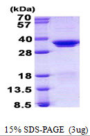 SDS-PAGE gel of recombinant human SFRS1 protein under reducing conditions stained with Coomassie blue