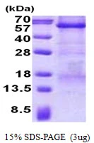SDS-PAGE gel of recombinant human Carboxypeptidase E CPE protein under reducing conditions