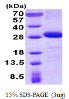 SDS-PAGE of recombinant human DNAM-1 CD226 protein under reducing conditions