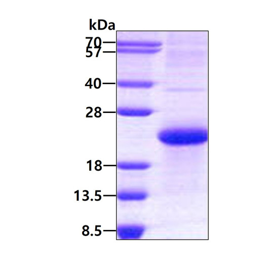 SDS-PAGE gel of recombinant human DAN protein 3μg under reducing conditions Coomassie blue stain