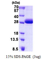 SDS-PAGE gel of recombinant human DGCR6 protein under reducing conditions stained with Coomassie blue