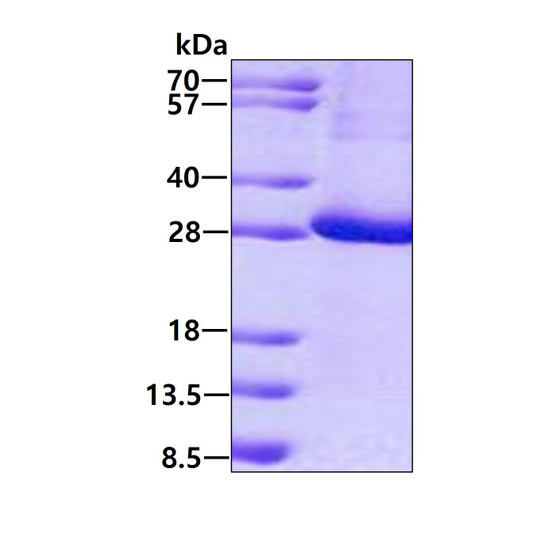 SDS-PAGE gel of recombinant human KCTD11 protein 3ug Coomassie blue stain reducing