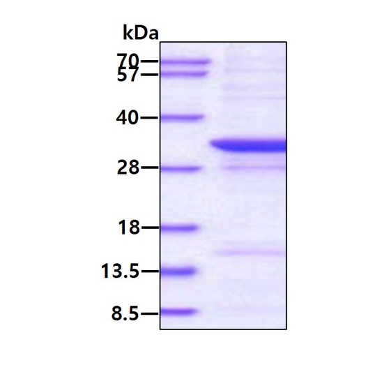 SDS-PAGE gel of recombinant human NCEH1 protein 3μg under reducing conditions Coomassie blue stain