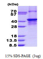 SDS-PAGE gel of recombinant human PARP2 protein under reducing conditions with Coomassie stain