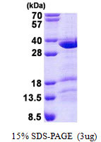 SDS-PAGE gel of recombinant human CCDC43 protein under reducing conditions