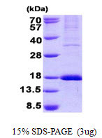 SDS-PAGE gel showing recombinant human GPR177 WLS protein under reducing conditions