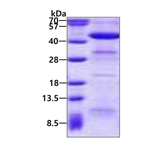 SDS-PAGE gel showing recombinant human ACAA2 protein 3µg under reducing conditions Coomassie blue stain