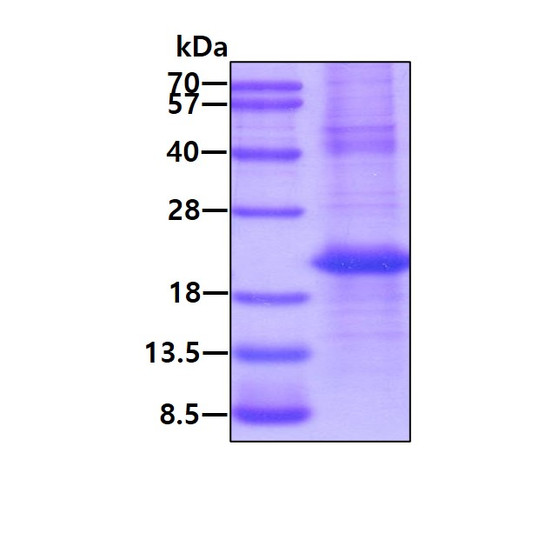 SDS-PAGE gel of recombinant human CAMP LL37 FALL39 protein under reducing conditions