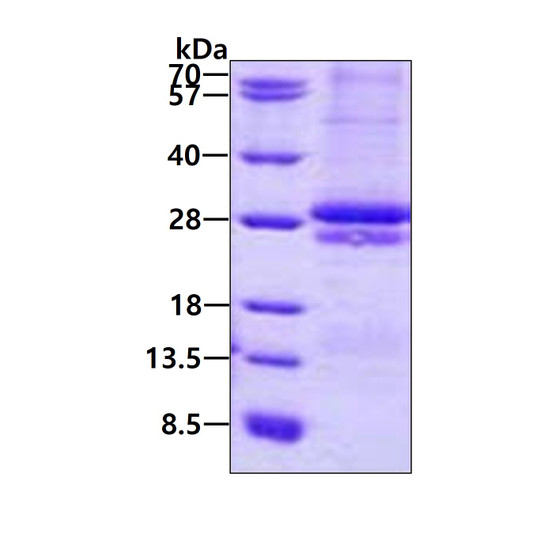 SDS-PAGE of recombinant human CRLF2 protein 3µg under reducing conditions Coomassie blue stain