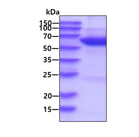 SDS-PAGE gel of recombinant human HSP60 protein 3µg under reducing conditions Coomassie blue stain