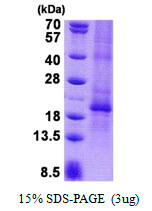 SDS-PAGE gel of recombinant human CGB protein 3µg under reducing conditions Coomassie blue stain