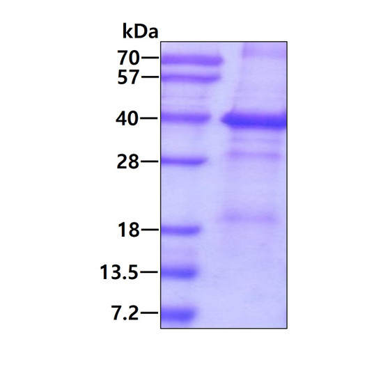 SDS-PAGE gel of recombinant human CD46 protein 3µg reducing conditions Coomassie stain