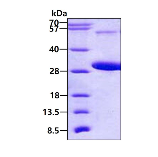 SDS-PAGE gel of recombinant human RAB5C protein 3µg under reducing conditions Coomassie blue stain