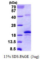 SDS-PAGE gel of recombinant human PRDC GREM2 protein under reducing conditions