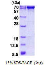 SDS-PAGE gel of recombinant human PDZK1 protein 3ug under reducing conditions