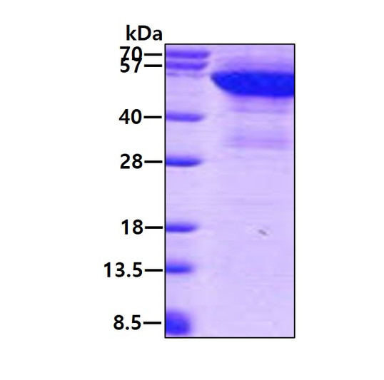 SDS-PAGE gel showing recombinant human Keratin 8 KRT8 protein under reducing conditions Coomassie blue stain