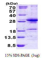 SDS-PAGE gel of recombinant human DGCR6L protein under reducing conditions stained with Coomassie blue