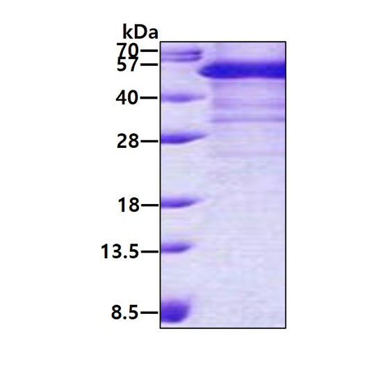 SDS-PAGE of recombinant human TDP-43 TARDBP protein under reducing conditions with Coomassie blue staining