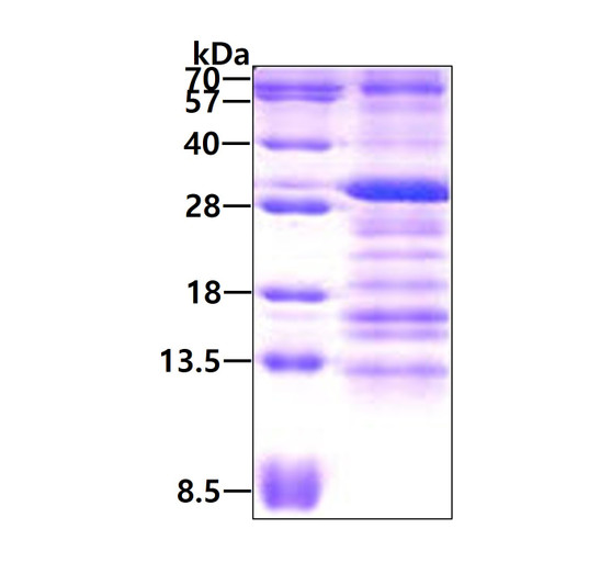 SDS-PAGE of recombinant human USE1 protein under reducing conditions with Coomassie blue stain