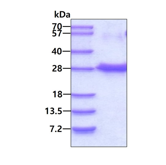 SDS-PAGE of recombinant human NUDT4 DIPP2 protein under reducing conditions stained with Coomassie blue