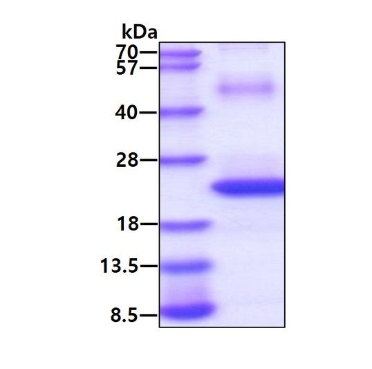 SDS-PAGE of recombinant human CD74 protein under reducing conditions stained with Coomassie blue