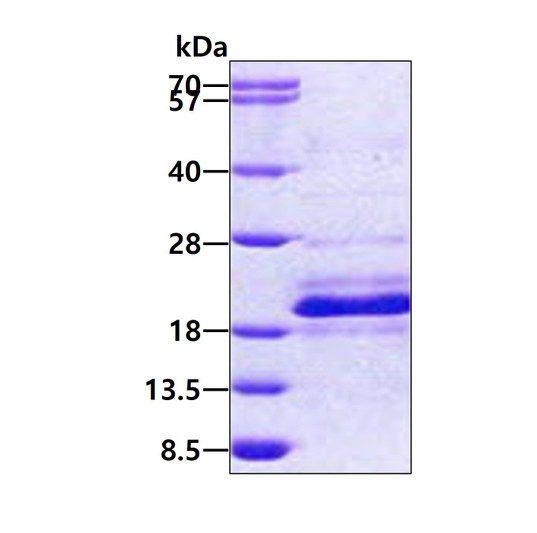 SDS-PAGE of recombinant human DNAJC24 protein under reducing conditions Coomassie blue stain