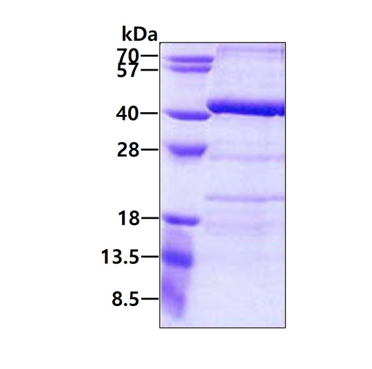 SDS-PAGE gel showing recombinant human ANKRD54 protein 3µg reducing conditions Coomassie stain