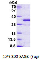 SDS-PAGE gel showing recombinant human FGF-14 protein under reducing conditions stained with Coomassie blue