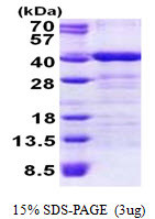SDS-PAGE gel of recombinant human TOMM34 protein under reducing conditions Coomassie blue stain