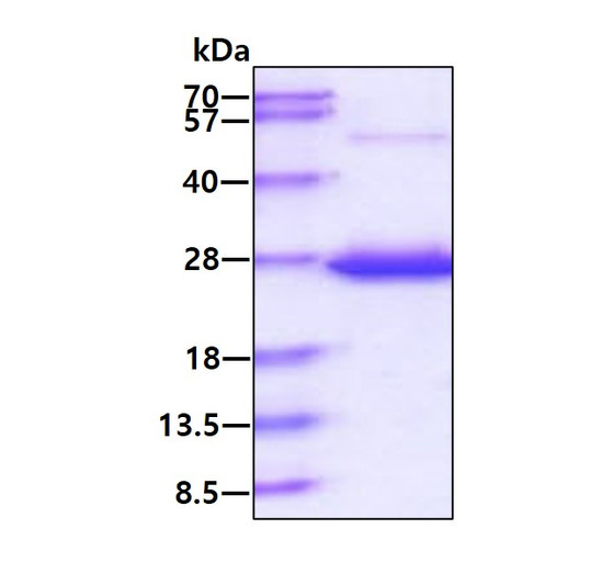 SDS-PAGE of recombinant human SCC-S2 TNFAIP8 protein under reducing conditions