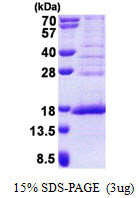 SDS-PAGE gel of recombinant human METTL21A protein under reducing conditions