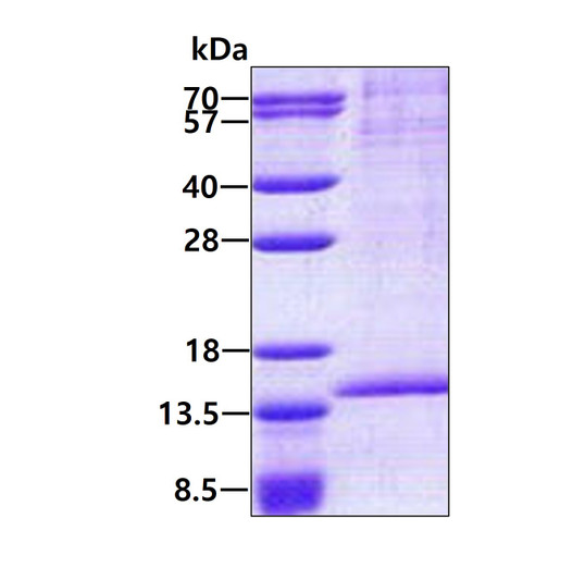 Recombinant human RAB8B protein SDS-PAGE gel 3 μg Coomassie blue stain