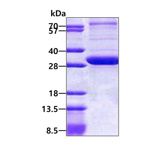 SDS-PAGE gel of recombinant human PEX26 protein stained with Coomassie blue
