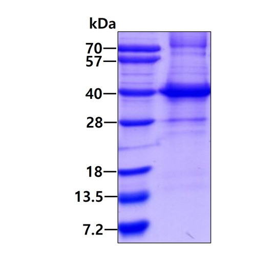 SDS-PAGE gel of recombinant human HLA-C protein 3µg under reducing conditions Coomassie blue stain