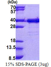 SDS-PAGE gel of recombinant human EMC2 protein under reducing conditions stained with Coomassie blue