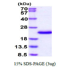 SDS-PAGE gel of recombinant human IL-36 gamma IL-1F9 protein under reducing conditions