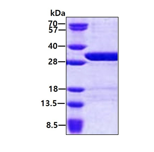 SDS-PAGE gel of recombinant human USP15 protein 3µg stained with Coomassie blue
