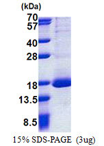 SDS-PAGE gel of recombinant human RPL30 protein 3µg reducing conditions Coomassie blue