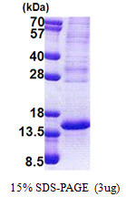 SDS-PAGE gel of recombinant human TP53AIP1 protein under reducing conditions stained with Coomassie blue