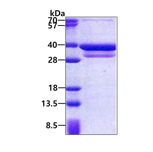 SDS-PAGE of recombinant human CUEDC2 protein under reducing conditions with Coomassie blue stain