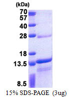 SDS-PAGE gel of recombinant human DNAJC15 protein under reducing conditions