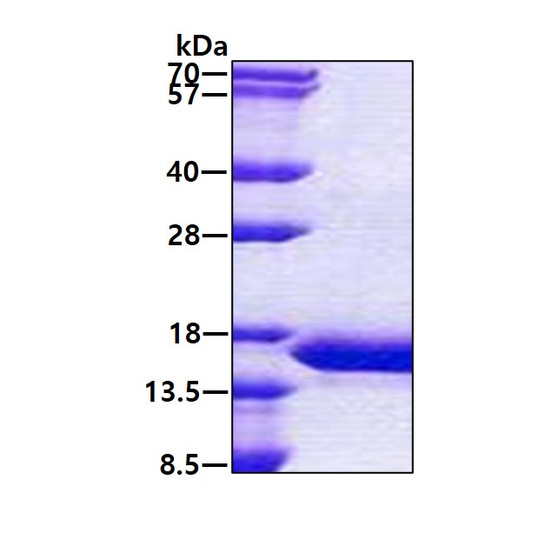 SDS-PAGE gel of recombinant human CARD17 protein under reducing conditions stained with Coomassie blue