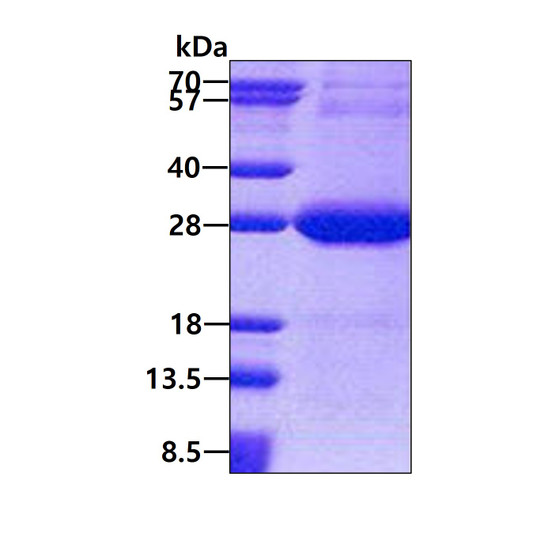 SDS-PAGE gel showing recombinant human NDUFV2 protein 3µg under reducing conditions with Coomassie blue stain