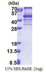 SDS-PAGE gel of recombinant human EBNA1BP2 protein 3ug under reducing conditions