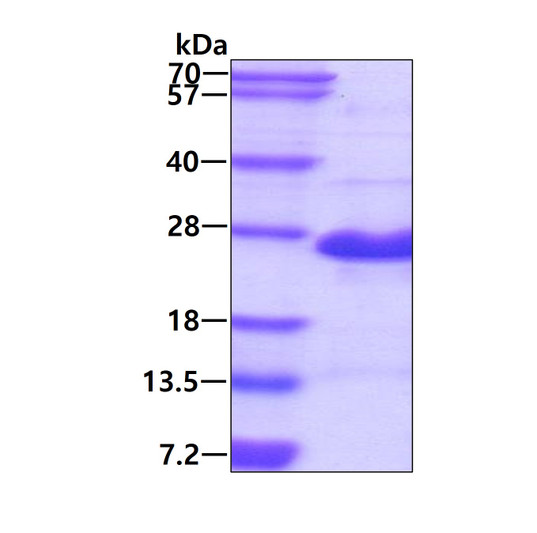 SDS-PAGE gel of recombinant human GAGE2A protein under reducing conditions stained with Coomassie blue