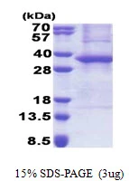 SDS-PAGE gel of recombinant human ASB8 protein 3µg under reducing conditions with Coomassie stain