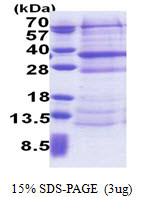 SDS-PAGE of recombinant human DCNL4 DCUN1D4 protein under reducing conditions