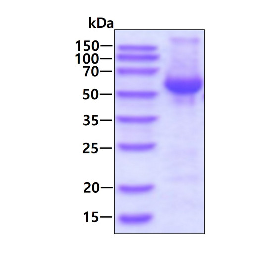 SDS-PAGE gel of recombinant human VPS4B protein stained with Coomassie blue