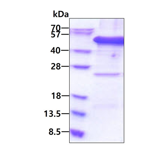 SDS-PAGE gel of recombinant human eIF-3 epsilon EIF3F protein STJP018460 under reducing conditions